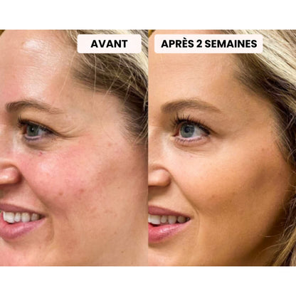 Masque LED - Dermalight X7