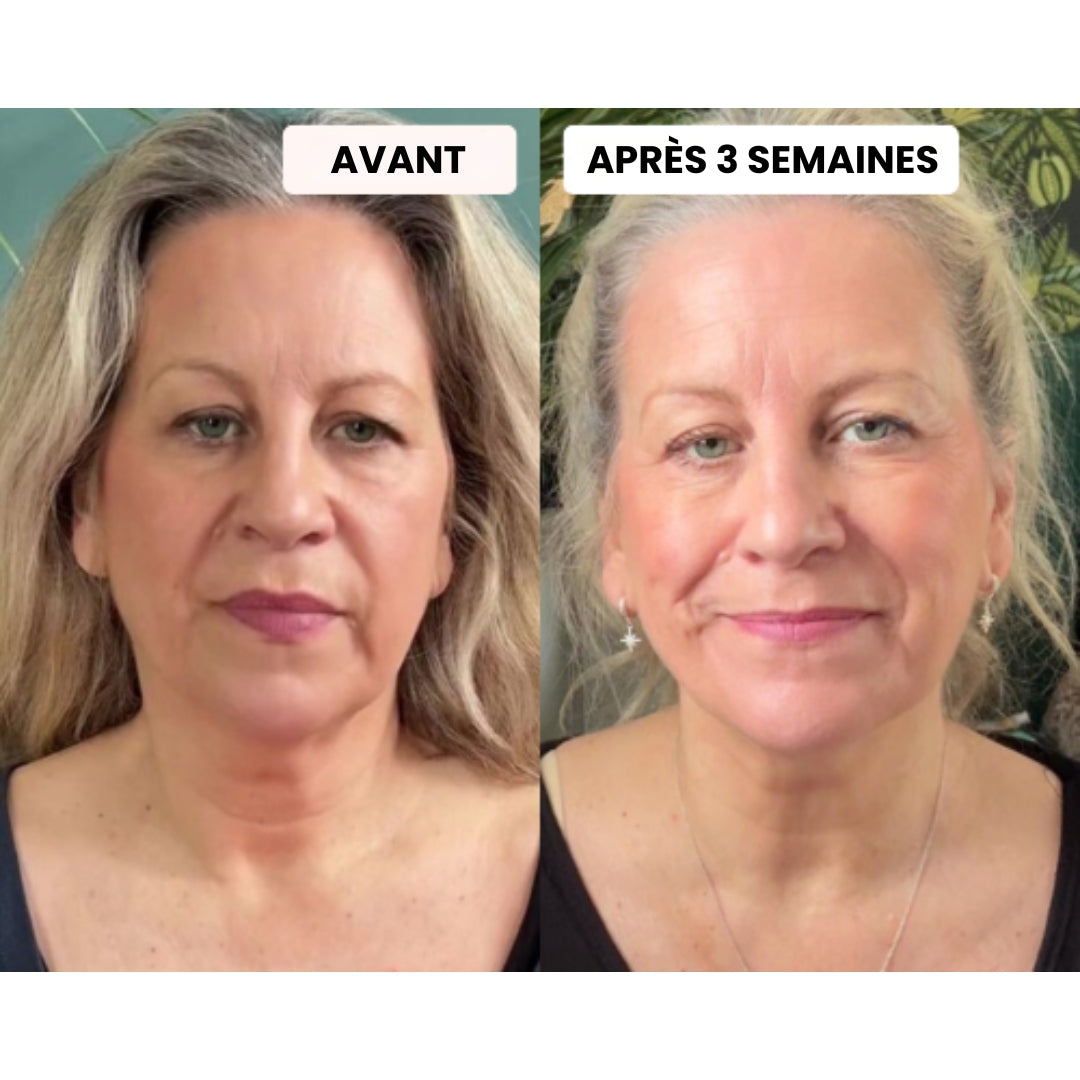 Masque LED - Dermalight X7