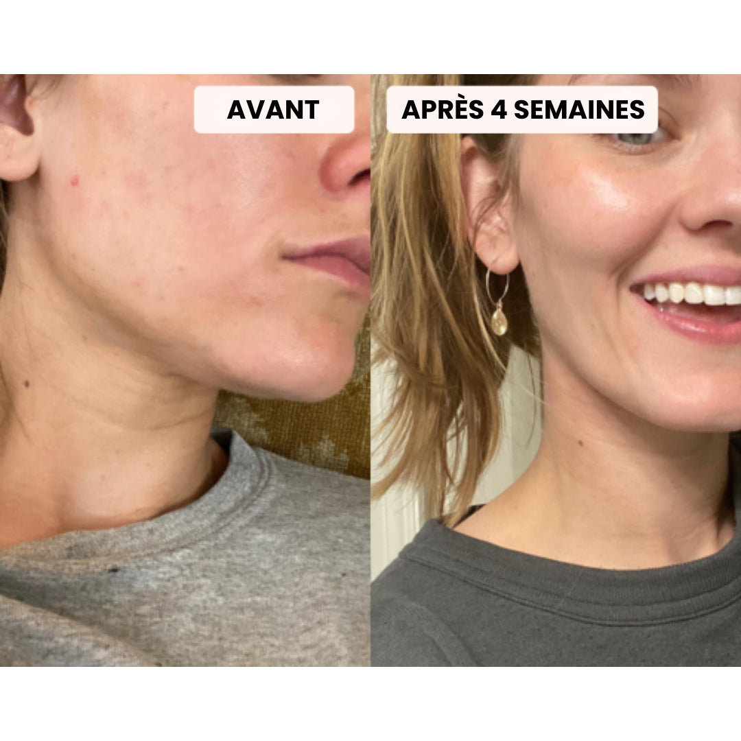 Masque LED - Dermalight X7