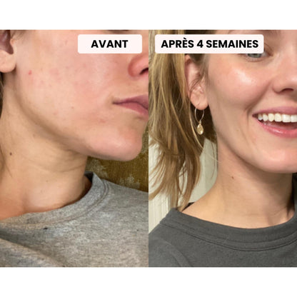 Masque LED - Dermalight X7