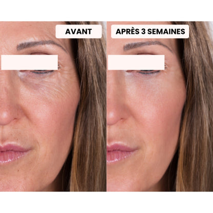 Masque LED - Dermalight X7