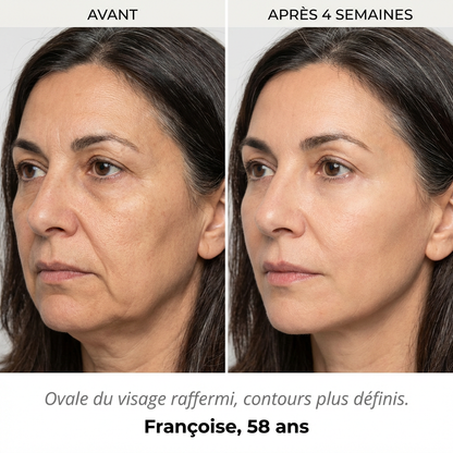 Masque LED Anti-Âge — Dermalight X7