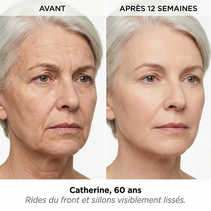 Masque LED Anti-Âge — Dermalight X7
