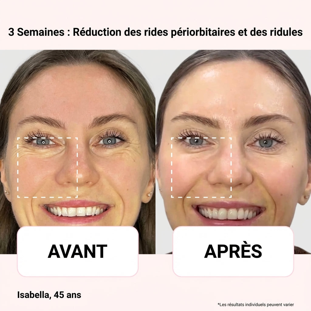 Lunette LED Anti-Cerne — Dermalight S600