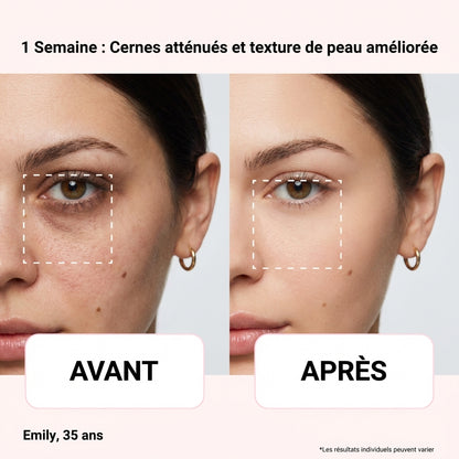 Lunette LED Anti-Cerne — Dermalight S600