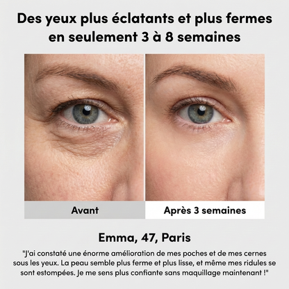 Lunette LED Anti-Cerne — Dermalight S600